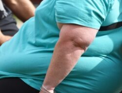 Bahaya! Ini Dampak Negatif Obesitas Bagi Kesehatan