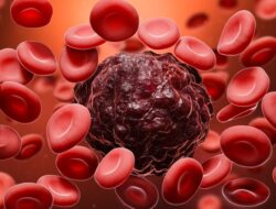 Mengungkap Realitas Penyakit Kanker: Penyebab, Pencegahan, dan Perawatannya