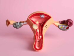 Menelusuri Penyebab, Gejala, dan Perawatan Kanker Rahim