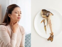 5 Tips Mengatasi Duri Ikan yang Nyangkut di Tenggorokan