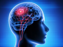 10 Makanan Enak yang Dapat Memicu Kanker Otak